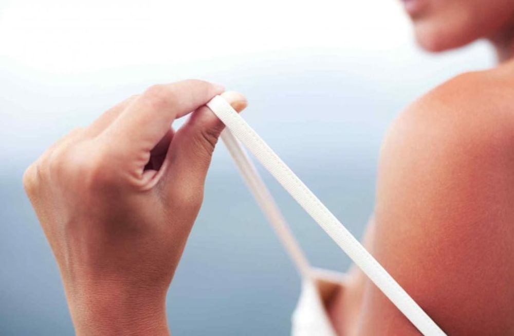 Guía para prevenir quemaduras del sol