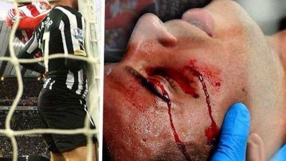 Un futbolista quiso cabecear y se accidentó al chocarse contra el poste del arco