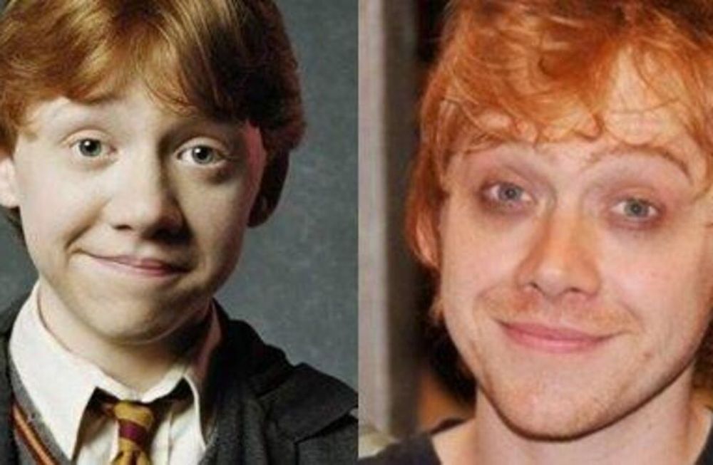 ¿Qué le pasó? Así luce hoy Rupert Grint