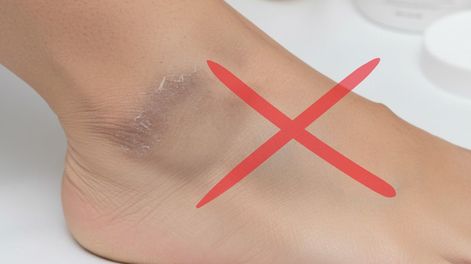 Combiná estos ingredientes para eliminar la piel muerta y las manchas oscuras de tobillos y rodillas