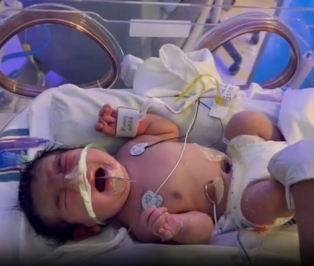 Los estudios revelaron que el bebé se había desarrollado fuera del útero, en la cavidad abdominal, cerca del hígado.