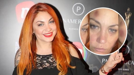 Lourdes de Bandana sorprendió al hacer público que fue víctima de violencia de género.
