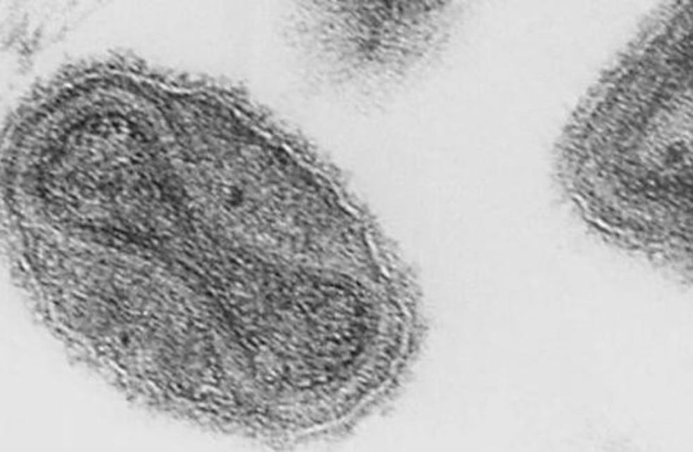 Todos los pacientes fueron atendidos y se encuentran en unidades especializadas en enfermedades infecciosas. Foto: Web / Los Andes