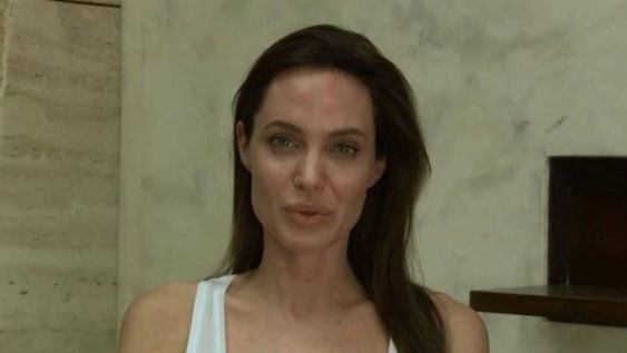 Angelina Jolie no lo puede creer: tiene varicela