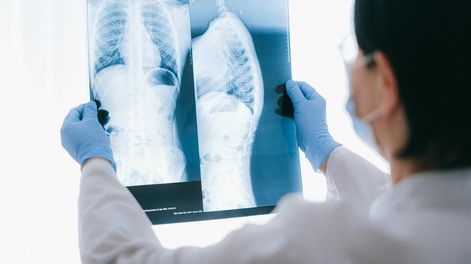 Patrones respiratorios acelerados se asocian con síntomas de ansiedad y depresión, según la investigación.