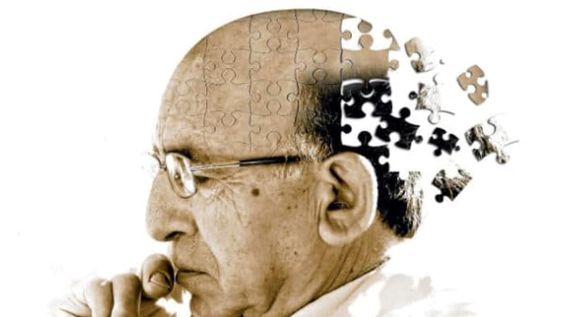 Una investigación concluyó que antecedentes de cáncer o enfermedad coronaria pueden reducir riesgos de desarrollar demencia.Foto gentileza: residentialplaza.com