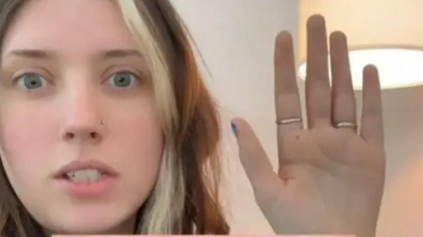 Le pidió a ChatGPT que lea su mano y la respuesta la envió urgente al médico.