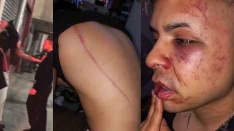 Video: patovicas de un boliche de Tucumán atacaron a latigazos a una pareja y les provocaron graves heridas. / Foto: captura de video / Los Andes