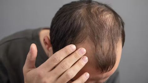No existe un truco definitivo pero hay diferentes formas de anticiparse a la caída constante del pelo.