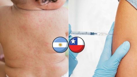 Caída de vacunación y sarampión: el vergonzoso dato de Argentina que obligó a Chile a tomar medidas