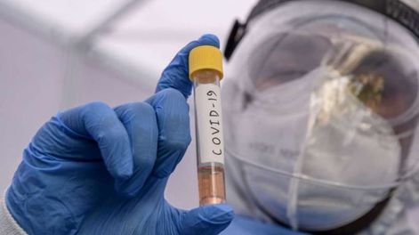 Confirman los primeros casos en Argentina de la variante Frankenstein del Covid-19.