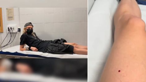 Los Andes | La actriz y cantante Taylor Momsen (Gossip Girl), acabó en urgencias tras el mordisco del animal. Foto: La Vanguardia