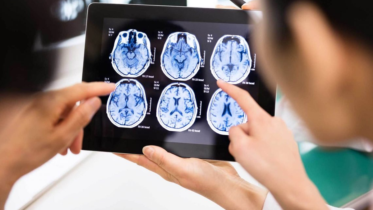 Le diagnosticaron estrés, pero tenía un tumor cerebral: la millonaria demanda que pide de indemnización