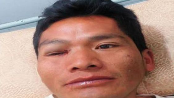 Acuchillan a un árbitro tras un partido en Bolivia