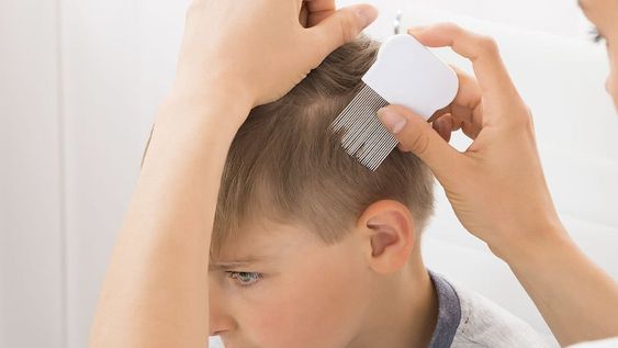 Comienzo de clases: ¡S.O.S. piojos!