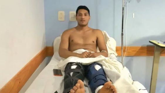 Benjamín Roldán entró al quirófano para que le intervengan una de sus piernas y cuando se despertó le habían operado las dos. Foto: Gentileza El Día.