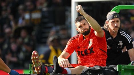 Maxime Crepeau se perderá el Mundial de Qatar por una fractura en su tobillo derecho.