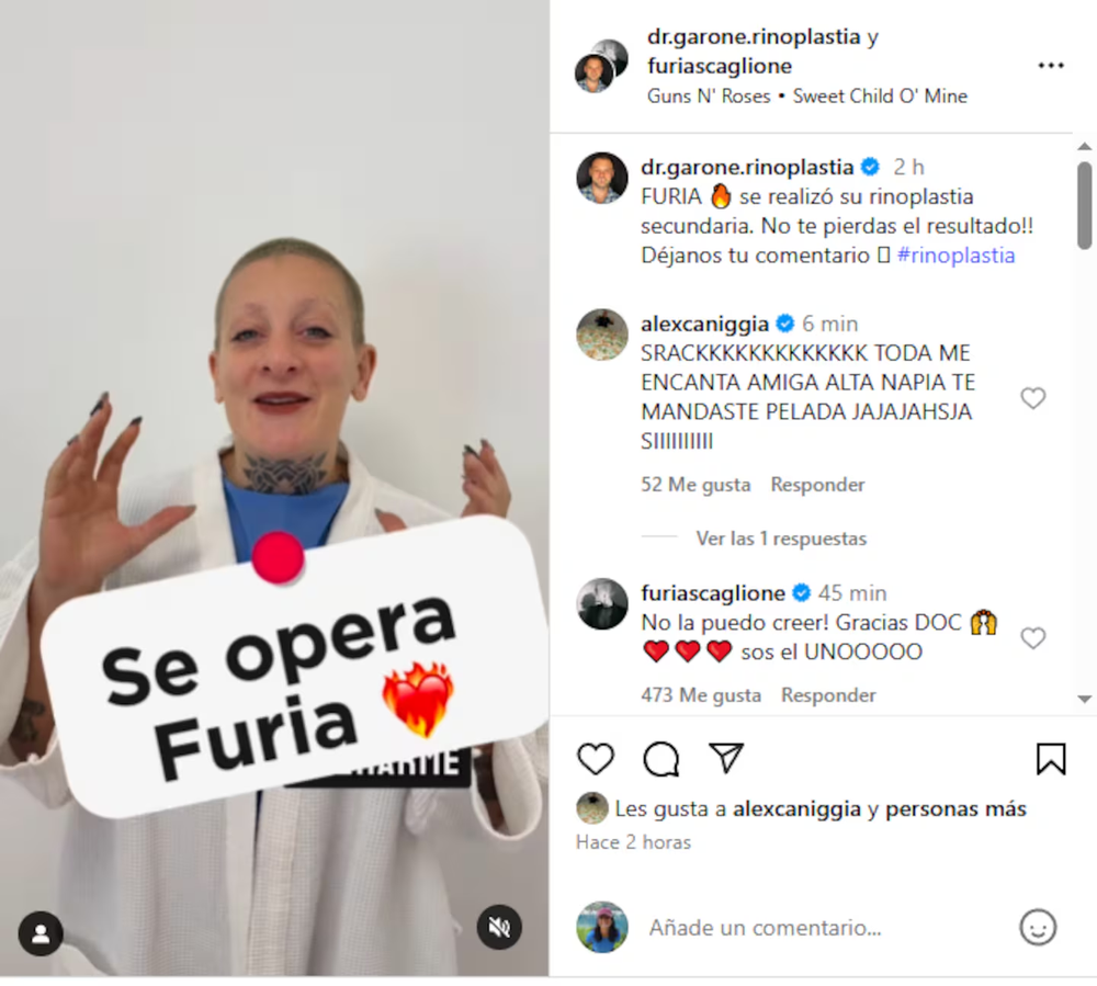 Furia de Gran Hermano se sometió a una operación y mostró el antes y después.