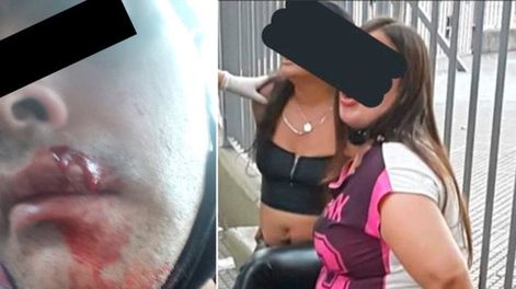Dos mujeres atacaron con piedras al Policía que les pidió que se colocaran el barbijo.