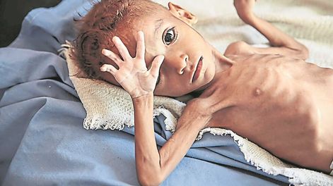 La muerte de Amal obliga a mirar la tragedia de Yemen