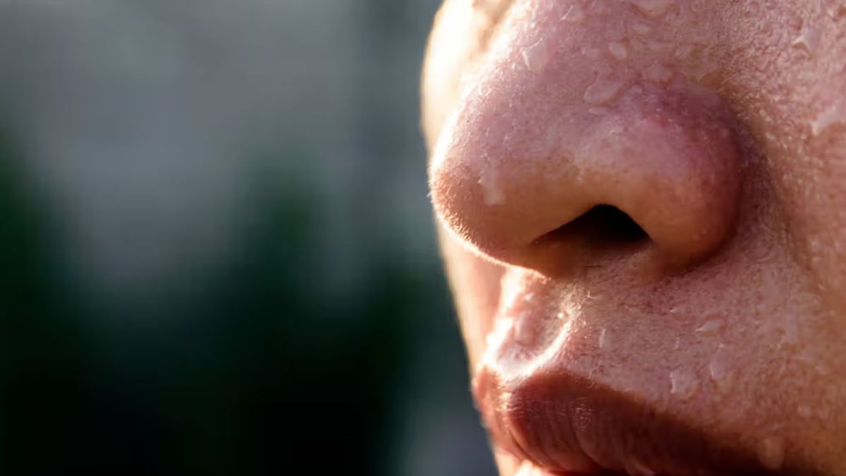 Qué es la hiperhidrosis, por qué las personas la sufren diariamente y cómo puede solucionarse