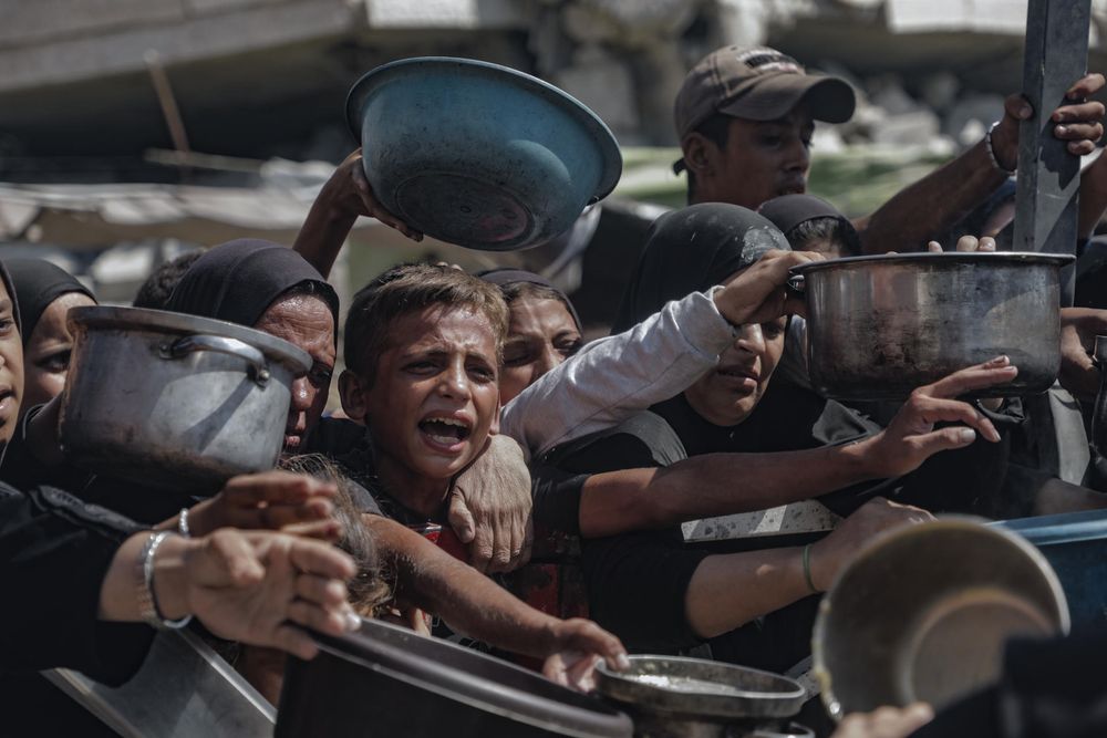 El síndrome de Guillain-Barré paraliza a la población en Gaza,