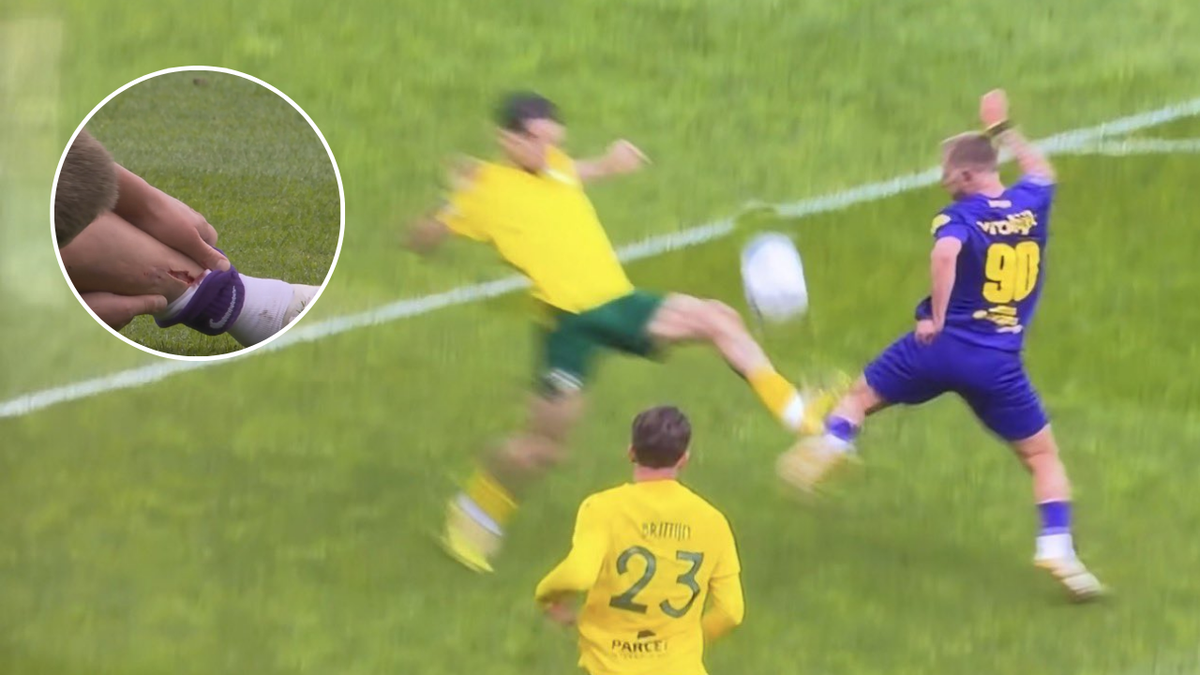 Alarma en Países Bajos: la impactante lesión que reaviva el debate por las canilleras