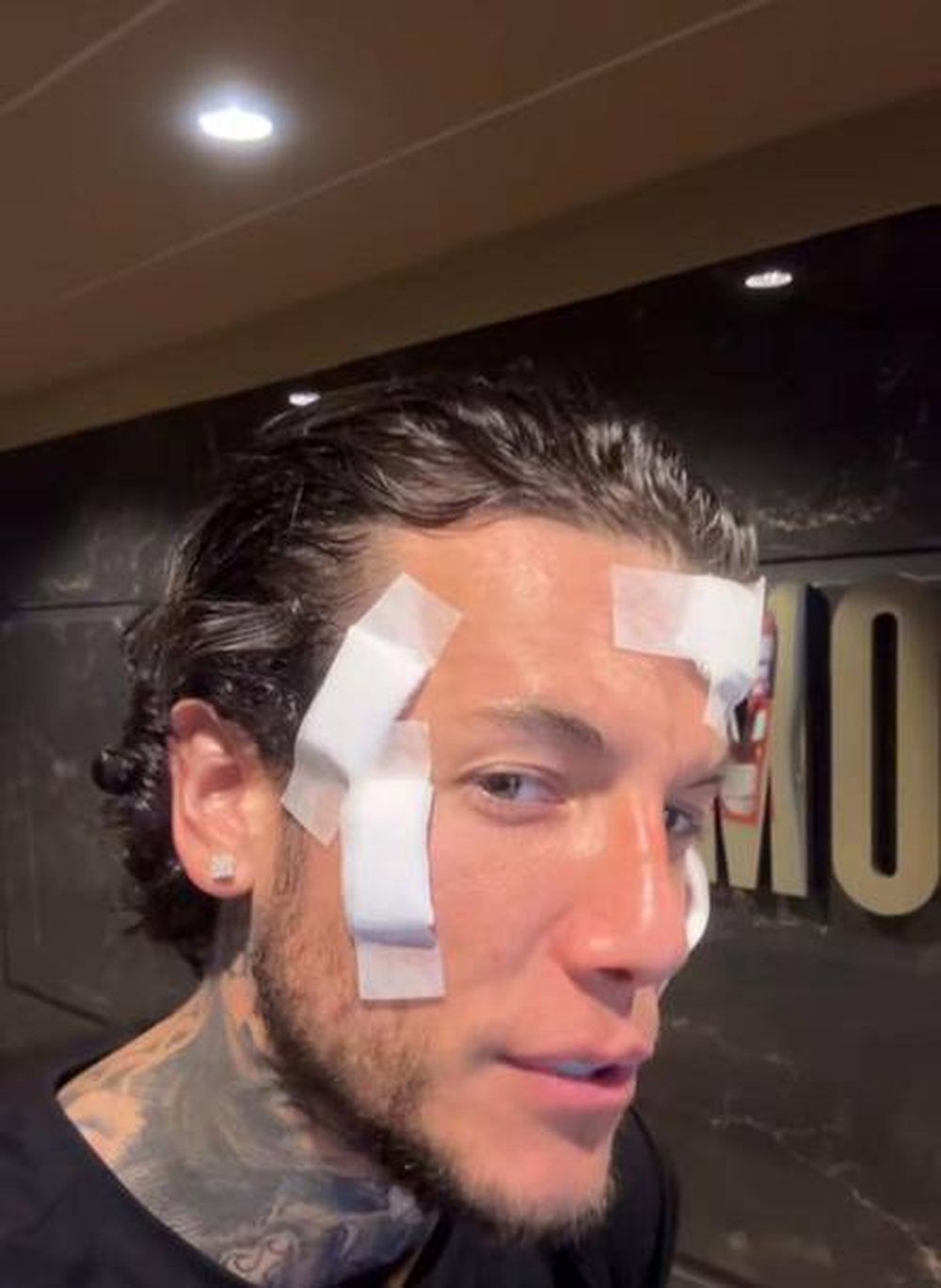 Alex Caniggia comenzó un tratamiento para quitarse los tatuajes.