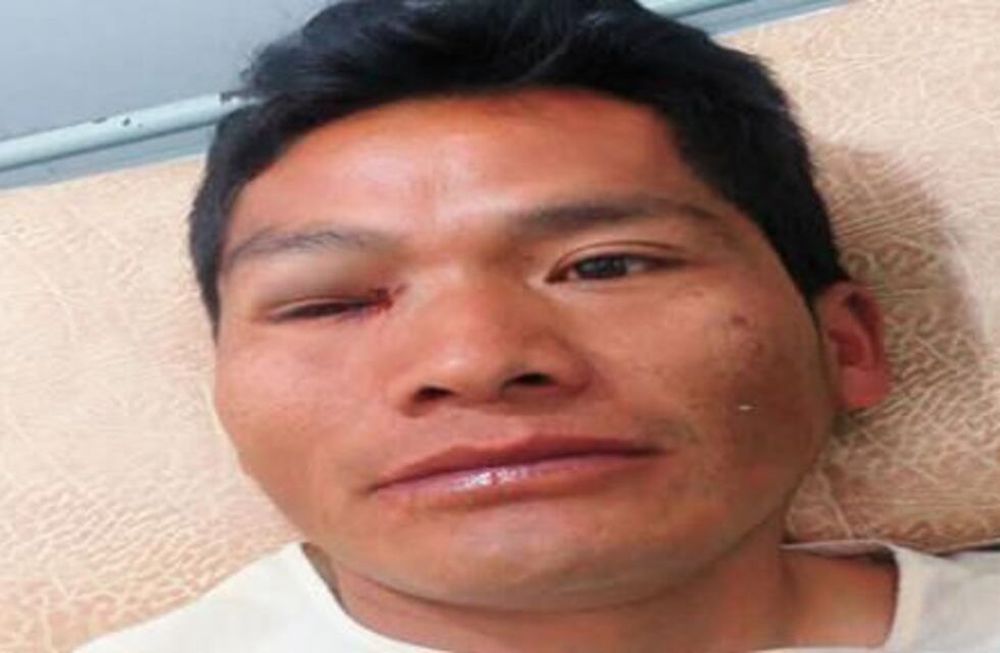 Acuchillan a un árbitro tras un partido en Bolivia