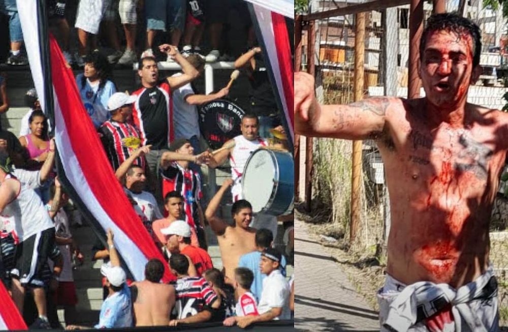 EL LÍDER DE LA BARRA BRAVA DE CHACARITA BAÑADO EN SANGRE TRAS UN ENFRENTAMIENTO. / GENTILEZA.