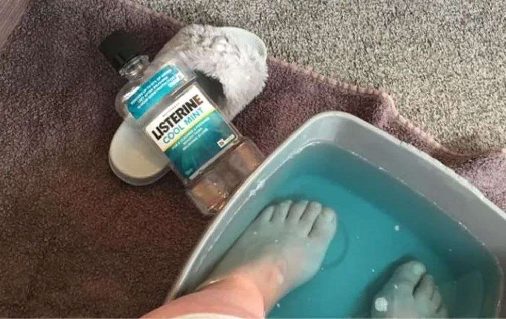 Es importante no usar este método si hay heridas abiertas, grietas muy profundas o irritación visible.