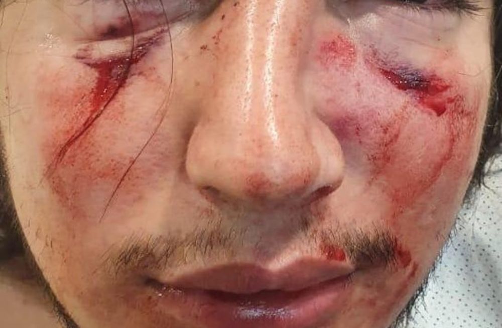 Córdoba. Un joven de 18 años fue brutalmente atacado por una patota de rugbiers