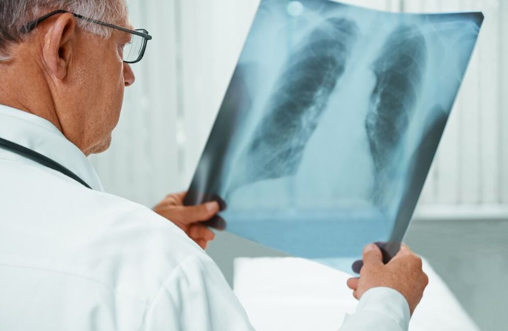 En Mendoza hay 150 casos nuevos de Tuberculosis por año