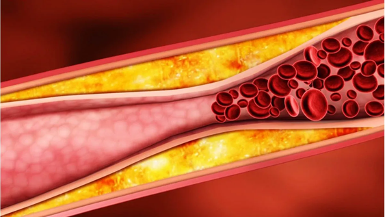 La fruta que limpia arterias, mejora la circulación y protege el corazón.