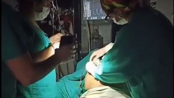 Médicos terminaron una cirugía con las linternas de sus celulares tras un corte de luz en el Hospital Zonal de Esquel