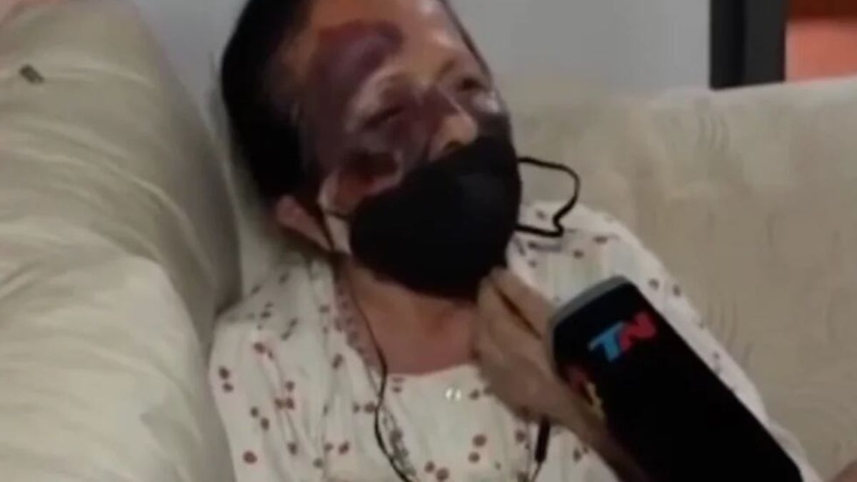 Asaltaron y golpearon a una mujer de 70 años en su casa para robarle la ...