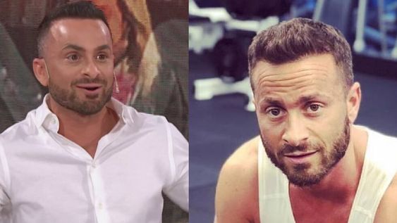 ¡Irreconocible! Martín Baclini se puso bótox y reapareció en la tele