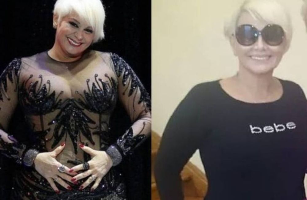 Carmen Barbieri se hará otro combo de cirugías estéticas
