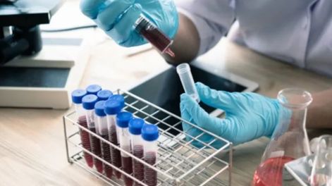 Bioquímicos alertan sobre una práctica que, aseguran, vulnera derechos básicos de los pacientes: la retención de las órdenes médicas para análisis clínicos