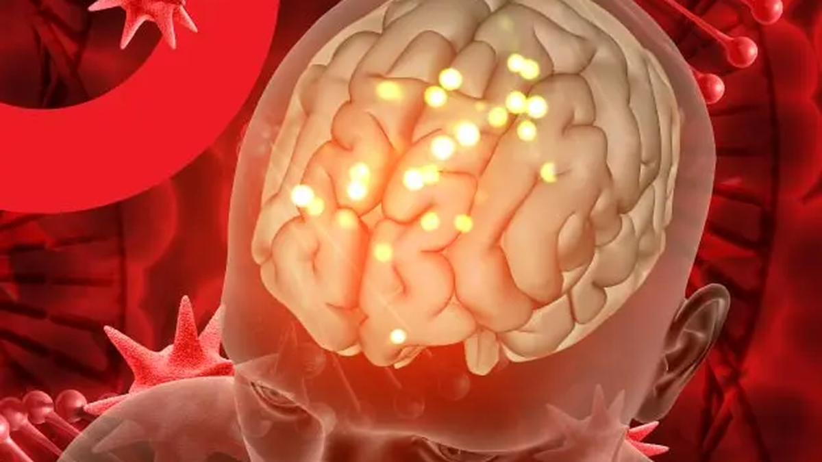 Inquietud por el aumento de meningitis en Argentina, una enfermedad que registra 70 casos por año en Mendoza