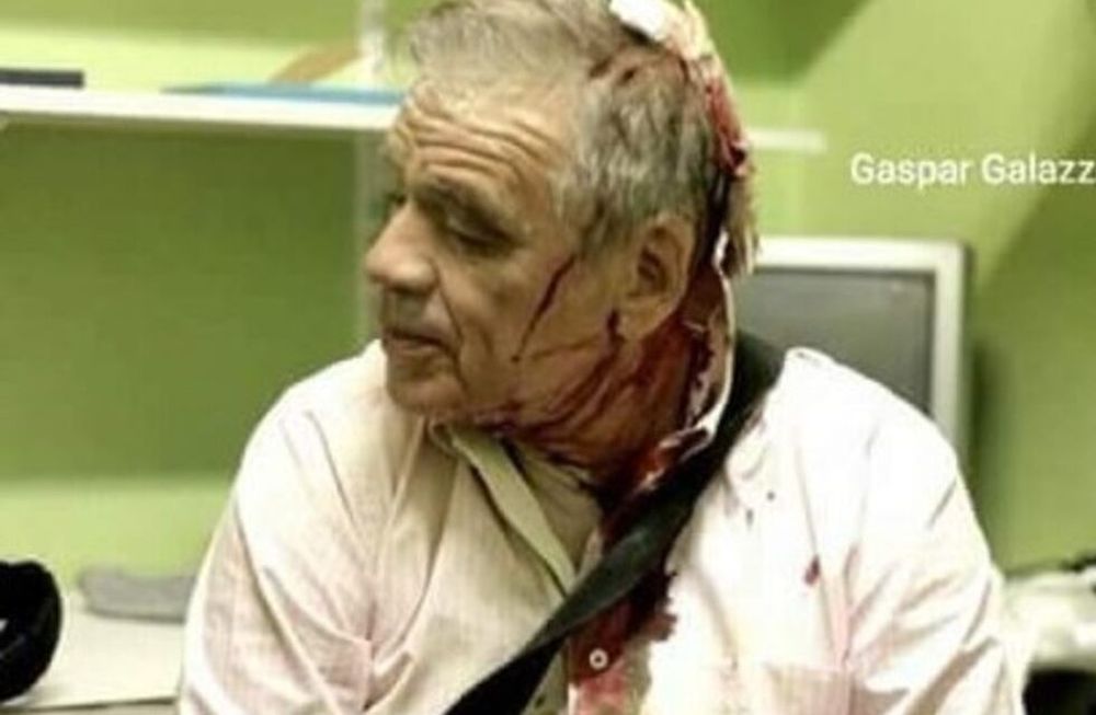 La impactante foto del periodista Julio Bazán tras las agresiones