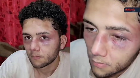 Un joven denunció que sus jefes lo secuestraron y golpearon para no pagarle.