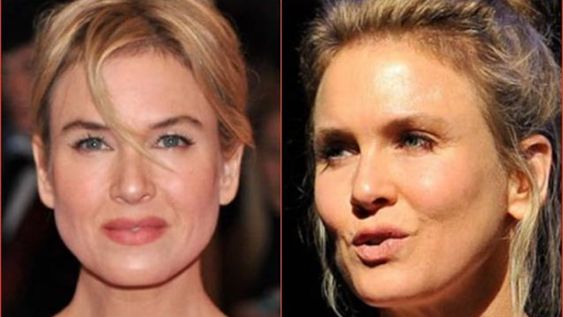 Renée Zellweger salió a explicar qué le pasó en la cara