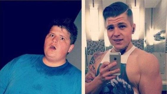 Un hombre bajó 72 kilos y creó un video sobre la piel que le sobró