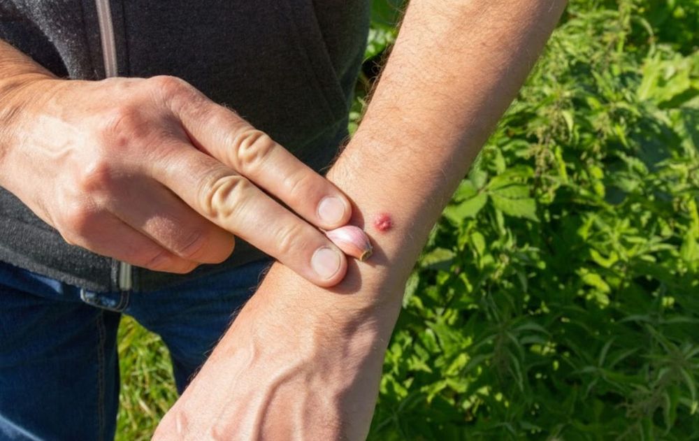 El ajo es una opción práctica para una acción rápida ante las picaduras de mosquitos.