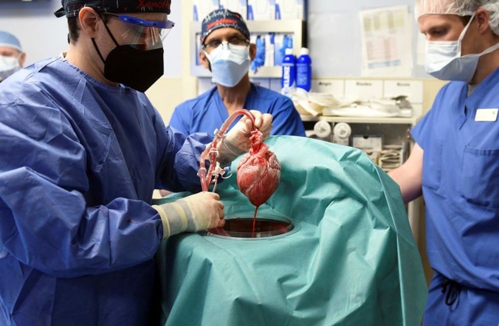 Un equipo de cirujanos de los Estados Unidos trasplantó con éxito el corazón de un cerdo modificado genéticamente a un humano.