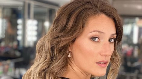 Mica Viciconte sufrió un accidente doméstico.