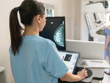 Cómo evolucionó la tecnología para la realización de mamografías.