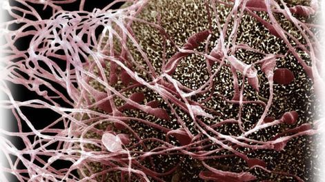 En defensa de la vida humana - Por Raúl Rodolfo Ripamonti