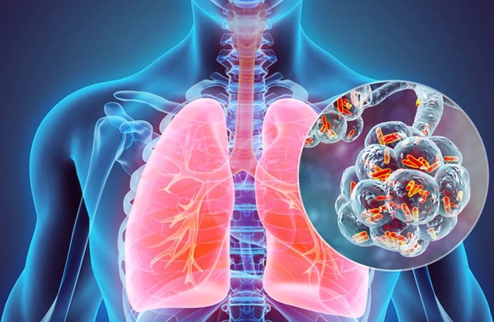 La forma de transmisión más frecuente de Legionella es la inhalación de aerosoles contaminados. Foto: Web